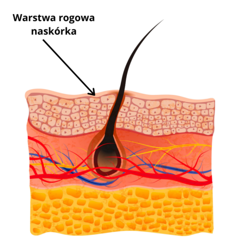 Skóra sucha traci wodę przez uszkodzoną warstwę rogową naskórka