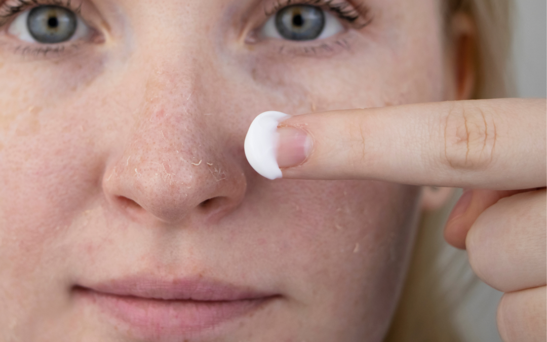 Suche skórki na twarzy – jak się ich pozbyć?