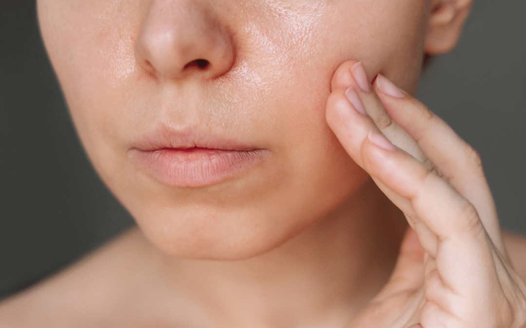 Tłusta skóra – przyczyny, objawy, pielęgnacja